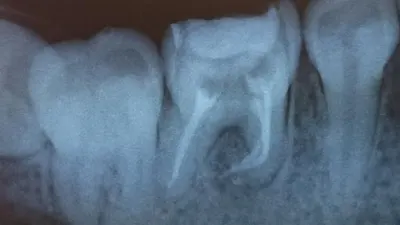 Indywidualna Praktyka Dentystyczna Izabela Denisiuk